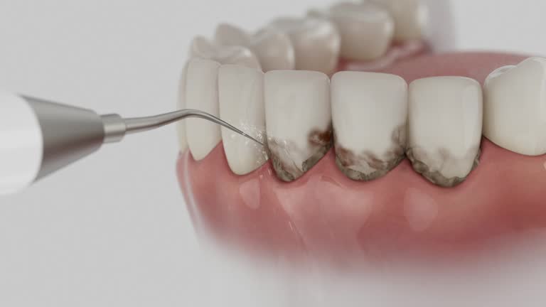 Reliable Dental contractor in Amherst, OH by Dentist Open Now